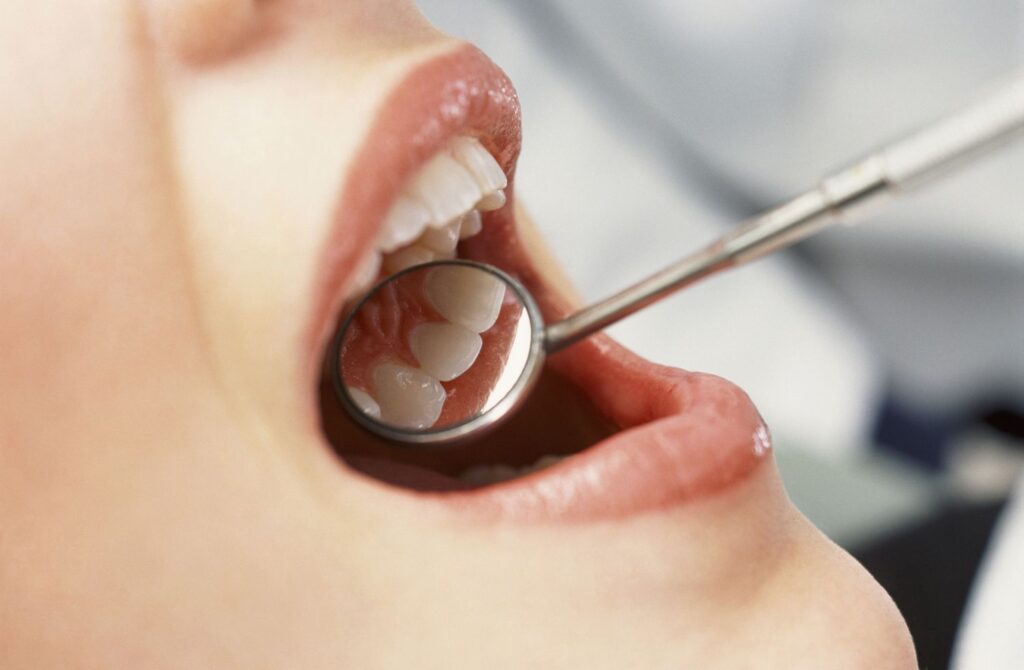 How Can a Family Dentist Help Minimize Your Dental Problems?